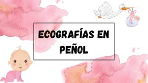 exografias-penol